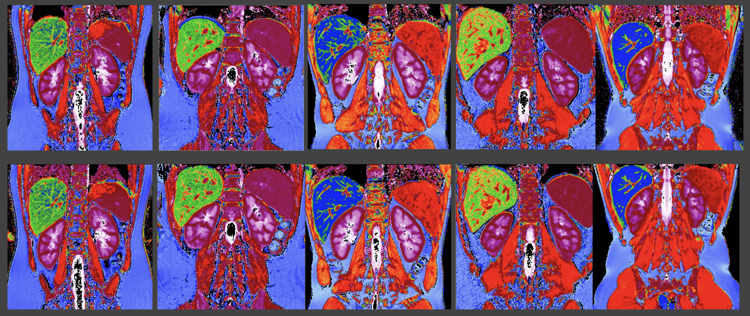 Kidney Imaging
